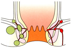 肛周炎