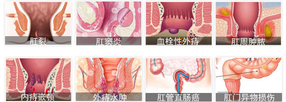 肛門(mén)疼的(de)病因
