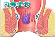 內(nèi)痔