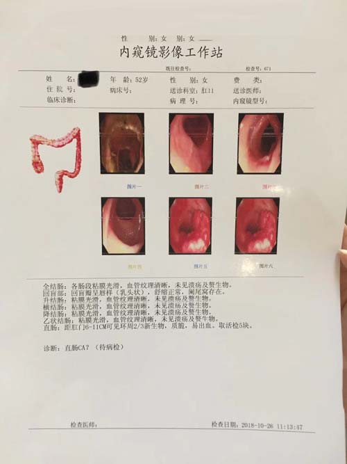 直腸腫瘤報(bào)告檢查單
